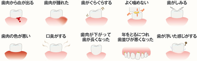 歯周病のチェックポイント